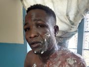 Jealousy turns violent- woman pours boiling tea on husband