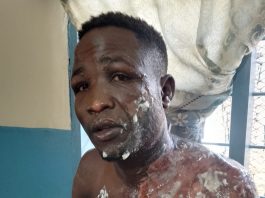 Jealousy turns violent- woman pours boiling tea on husband