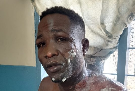 Jealousy turns violent- woman pours boiling tea on husband