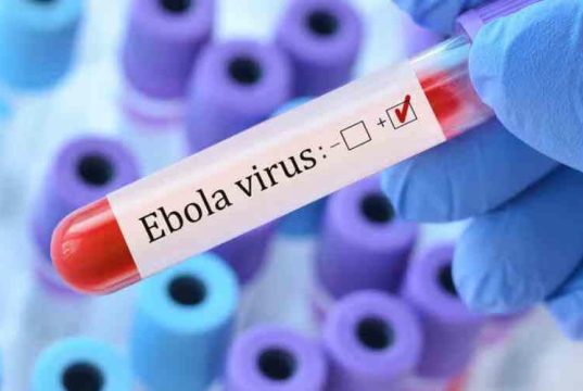 Kenya confirms first Ebola case as Health teams trace 55 contacts